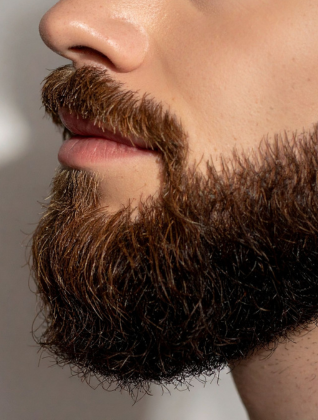 Beard transplant